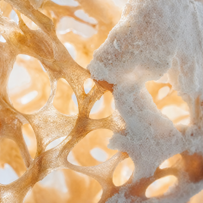 Calcified Elastic Fiber
